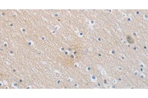 Immunohistochemistry of paraffin-embedded Human brain using SLC16A7 Polyclonal Antibody at dilution of 1:30 (SLC16A7 抗体)