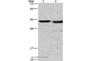 Western blot analysis of Mouse kidney tissue and A172 cell, using CTSL Polyclonal Antibody at dilution of 1:900 (Cathepsin L 抗体)