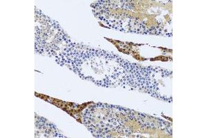 Immunohistochemistry of paraffin-embedded rat testis using FMOD antibody. (Fibromodulin 抗体  (AA 19-376))