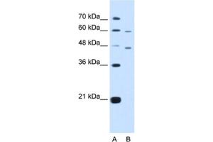 Western Blotting (WB) image for anti-Cysteine-Rich with EGF-Like Domains 1 (CRELD1) antibody (ABIN2464001)