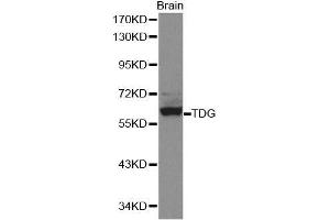 Western blot analysis of extracts of mouse brain, using TDG antibody. (TDG 抗体  (AA 1-160))