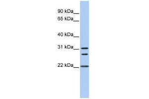 Calponin 1 antibody used at 1 ug/ml to detect target protein. (CNN1 抗体  (N-Term))
