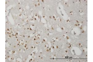 Immunoperoxidase of monoclonal antibody to GPR135 on formalin-fixed paraffin-embedded human cerebral cortex. (GPR135 抗体  (AA 391-493))