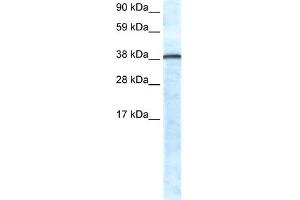 WB Suggested Anti-GFI1 Antibody Titration:  0. (GFI1 抗体  (N-Term))