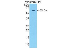 Western Blotting (WB) image for anti-Complement Factor B (CFB) (AA 34-159) antibody (ABIN1858377) (Complement Factor B 抗体  (AA 34-159))