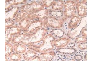 IHC-P analysis of Human Kidney Tissue, with DAB staining. (POR 抗体  (AA 77-518))