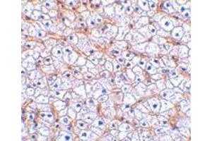 Immunohistochemistry of TNFRSF12A in human liver tissue with TNFRSF12A polyclonal antibody  at 2. (TNFRSF12A 抗体)