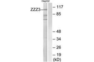 Western blot analysis of extracts from HepG2 cells, using ZZZ3 Antibody.