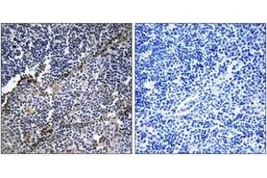 Immunohistochemistry (IHC) image for anti-Collagen, Type XIX, alpha 1 (COL19A1) (AA 421-470) antibody (ABIN2889926)
