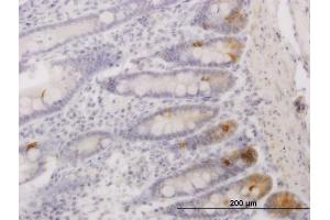 Immunoperoxidase of monoclonal antibody to SFRS17A on formalin-fixed paraffin-embedded human small Intestine. (SFRS17A 抗体  (AA 53-156))