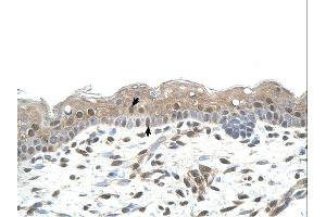 Immunohistochemistry (IHC) image for anti-Ring Finger Protein 25 (RNF25) (Middle Region) antibody (ABIN2774774) (RNF25 抗体  (Middle Region))