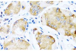 Immunohistochemistry of paraffin-embedded Human stomach using ACVR1C Polyclonal Antibody at dilution of 1:100 (40x lens).