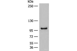 Western Blotting (WB) image for anti-CTD (Carboxy-terminal Domain, RNA Polymerase II, Polypeptide A) Phosphatase, Subunit 1 (CTDP1) antibody (ABIN7244948)