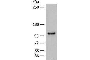Western blot analysis of HEPG2 cell lysate using CTDP1 Polyclonal Antibody at dilution of 1:500 (CTDP1 抗体)
