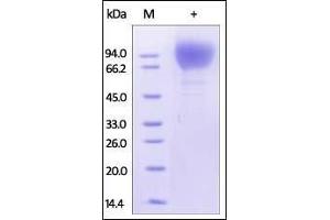 HIV-1 [HIV-1/Clade C (16055)] GP120 on SDS-PAGE under reducing (R) condition. (Human Immunodeficiency Virus Surface Glycoprotein (HIV gp120) (AA 34-506) (Active) protein (His tag))