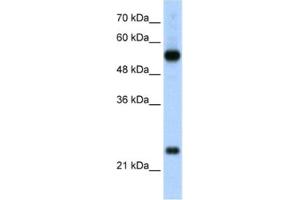 Western Blotting (WB) image for anti-Ribosomal Protein L13 (RPL13) antibody (ABIN2462056)