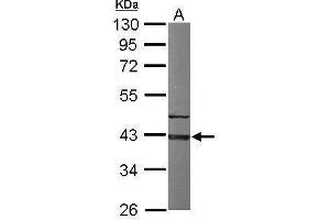 WB Image Sample (50 ug of whole cell lysate) A: Mouse brain 10% SDS PAGE antibody diluted at 1:1000 (G Protein alpha Inhibitor 3 (Center) 抗体)