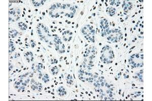 Image no. 1 for anti-Checkpoint Kinase 2 (CHEK2) antibody (ABIN1497496) (CHEK2 抗体)
