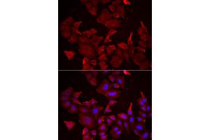 Immunofluorescence analysis of HeLa cells using CASP14 antibody (ABIN5973925). (CASP14 抗体)