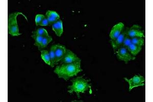 Immunofluorescence (IF) image for anti-Adaptor-Related Protein Complex 1, gamma 1 Subunit (AP1G1) (AA 592-686) antibody (ABIN7144346)