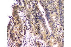 IHC analysis of SHP2/PTPN11 using anti SHP2/PTPN11 antibody (ABIN6719583).