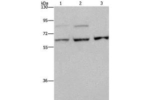 Western Blot analysis of A431, MCF-7 and Hela cell using KIF22 Polyclonal Antibody at dilution of 1:200 (KIF22 抗体)