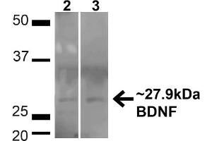 Western blot analysis of Human HeLa and HEK293T cell lysates showing detection of ~27. (BDNF 抗体  (N-Term))