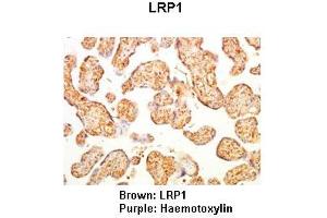 Lanes: Human placenta Primary Antibody Dilution: 1:500Secondary Antibody: Anti-rabbit-HRP Secondary Antibody Dilution: 1:0000  Gene Name: Brown: LRP1 Purple: Haemotoxylin Submitted by: LRP1 (LRP1 抗体  (Middle Region))