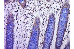 Immunohistochemistry (Paraffin-embedded Sections) (IHC (p)) image for anti-Placenta Growth Factor (PGF) (AA 166-221) antibody (ABIN727235)