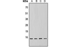 Western blot analysis of 4EBP1 (pT69) expression in HEK293T (A), NS-1 (B), H9C2 (C), rat liver (D) whole cell lysates. (eIF4EBP1 抗体  (pSer69))