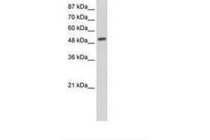 Image no. 1 for anti-Nuclear Receptor Subfamily 2, Group E, Member 3 (NR2E3) (N-Term) antibody (ABIN203119)