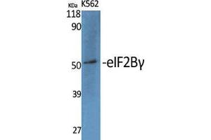 Western Blot (WB) analysis of specific cells using eIF2Bgamma Polyclonal Antibody. (EIF2B3 抗体  (Internal Region))
