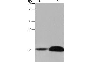 Western Blot analysis of Mouse kidney and Human kidney tissue using FHIT Polyclonal Antibody at dilution of 1:600 (FHIT 抗体)