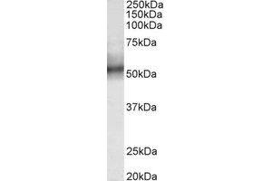 Western Blotting (WB) image for anti-Tripartite Motif Containing 11 (TRIM11) (Internal Region) antibody (ABIN2465007) (TRIM11 抗体  (Internal Region))