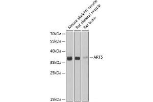 Western blot analysis of extracts of various cell lines using ART5 Polyclonal Antibody at dilution of 1:1000. (ART5 抗体)