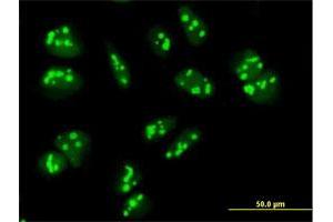Immunofluorescence of purified MaxPab antibody to PAK1IP1 on HeLa cell. (PAK1IP1 抗体  (AA 1-392))
