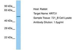 Image no. 1 for anti-Keratin 31 (KRT31) (AA 299-348) antibody (ABIN6750207) (Keratin 31 抗体  (AA 299-348))