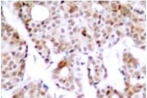 Image no. 1 for anti-Myc Proto-Oncogene protein (MYC) (pThr358) antibody (ABIN318074) (c-MYC 抗体  (pThr358))