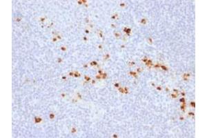 Immunohistochemistry (IHC) image for Rabbit anti-Human Immunoglobulin Heavy Constant gamma 1 (G1m Marker) (IGHG1) antibody (ABIN5580618)