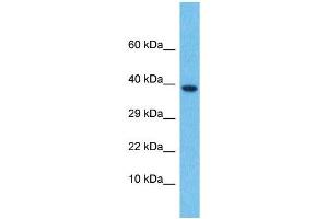 Host:  Rabbit  Target Name:  LEFTY2  Sample Type:  Thymus Tumor lysates  Antibody Dilution:  1. (LEFTY2 抗体  (N-Term))