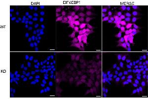 Immunocytochemical staining of HeLa cells using EIF4EBP1 antibody (ABIN7798532), 1:1,000), Top panel: wild-type (WT), Bottom panal: EIF4EBP1 shRNA knockdown (KD). (Recombinant eIF4EBP1 抗体)