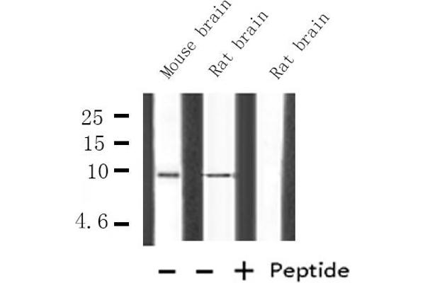 HMGN2 抗体  (Internal Region)