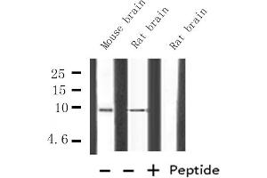 Western blot analysis of HMG17 expression in various lysates (HMGN2 抗体  (Internal Region))