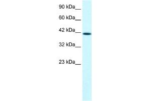 WB Suggested Anti-PTK2B Antibody Titration:  1. (PTK2B 抗体  (C-Term))