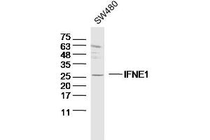 SW480 lysates probed with IFNE1 Polyclonal Antibody, Unconjugated  at 1:300 dilution and 4˚C overnight incubation. (IFNE 抗体  (AA 101-200))