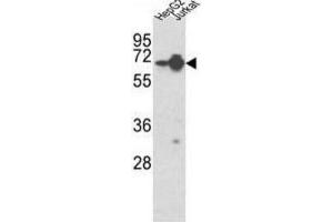Western Blotting (WB) image for anti-Heterogeneous Nuclear Ribonucleoprotein L (HNRNPL) antibody (ABIN3001739) (HNRNPL 抗体)