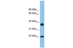 WFDC1 antibody used at 1 ug/ml to detect target protein. (WFDC1 抗体  (Middle Region))