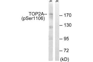 Western blot analysis of extracts from Jurkat cells, treated with paclitaxel (1uM, 24hours), using TOP2A (Phospho-Ser1106) antibody. (Topoisomerase II alpha 抗体  (pSer1106))