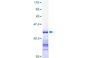 Image no. 1 for Cyclin B1 (CCNB1) (AA 1-90) protein (GST tag) (ABIN1348435) (Cyclin B1 Protein (CCNB1) (AA 1-90) (GST tag))