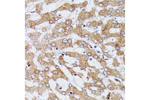 Immunohistochemistry of paraffin-embedded human liver using HDLBP antibody (ABIN6128051, ABIN6141701, ABIN6141702 and ABIN6221672) at dilution of 1:100 (40x lens). (HDLBP 抗体  (AA 1035-1268))